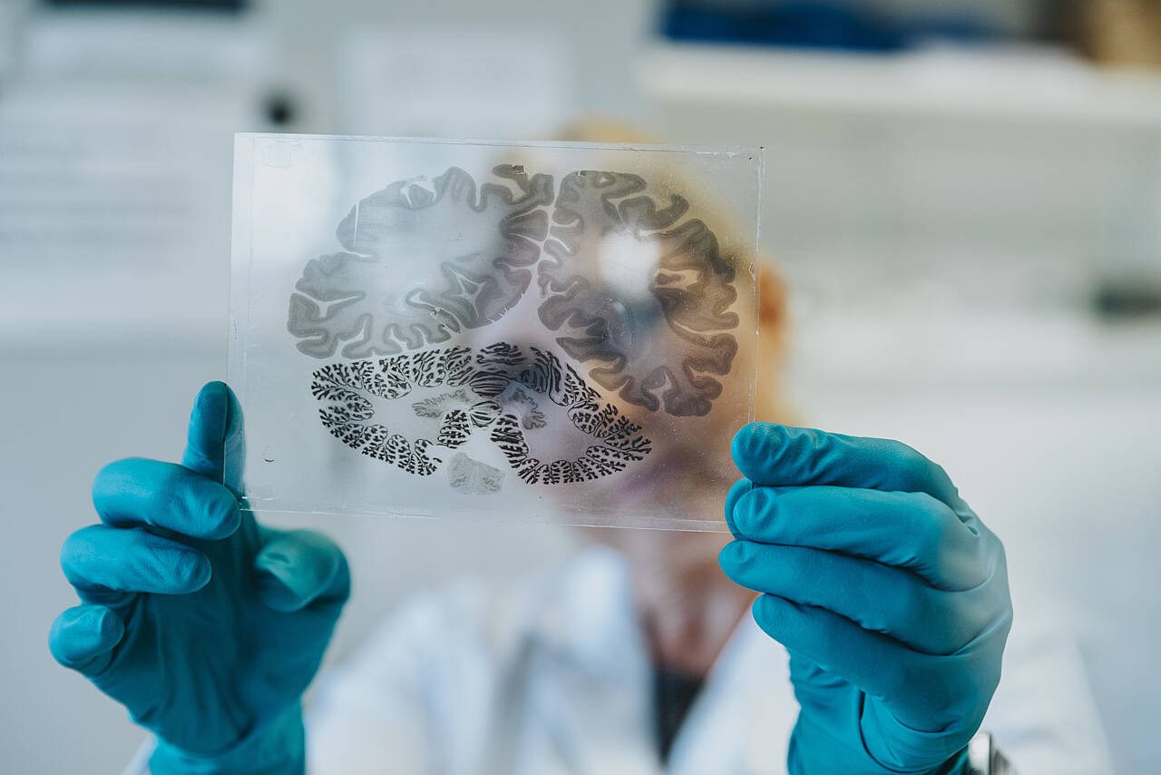 Wissenschaftlerin im Labor, die sich einen Mikroskop-Objektträger des menschlichen Gehirns anschaut.