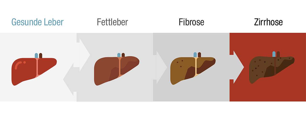 Darstellung der menschlichen Leber in vier Phasen