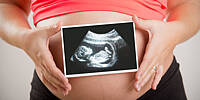 Schwangere Frau hält Ultraschallbild vor ihren Bauch.