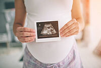 Schwangere Frau hält Ultraschallbild vor ihren Bauch