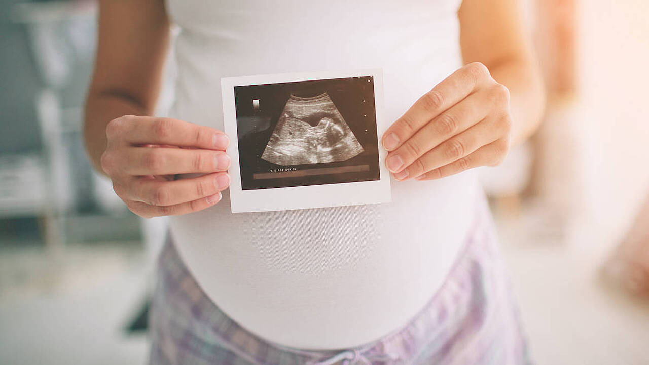 Schwangere hält Ultraschallbild vor ihren Bauch